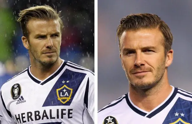 David Beckham Hair Line