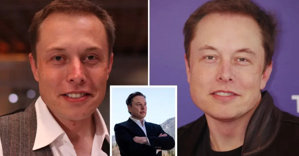Elon Musk Hair Transplant Photo